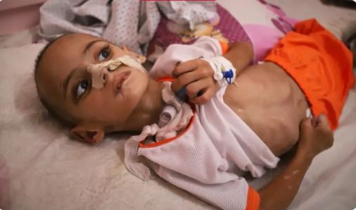 Amr Al Hams, another child brutally attacked by genocidal Israel